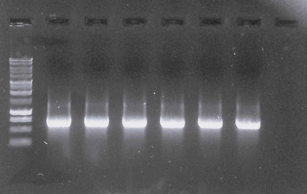 Electrophoresis gel